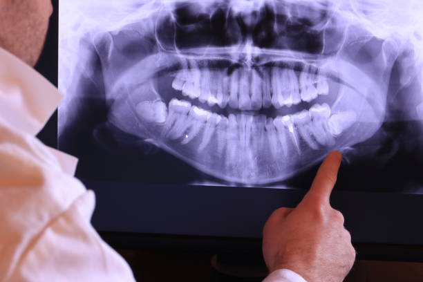 Best Same-Day Emergency Dental Services in Oxford, MI