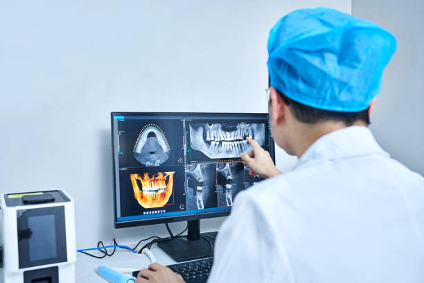 Best Emergency Wisdom Teeth Removal in Oxford, MI